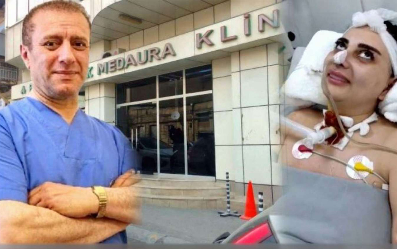 Burun əməliyyatından sonra komaya düşən Nigarın məhkəməsi başa çatıb