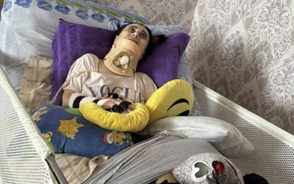 Rinoplastikadan sonra iflic olan 34 yaşlı qadın vəfat etdi